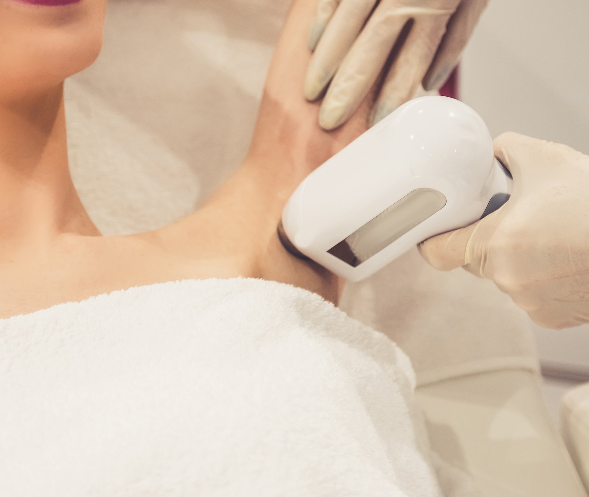 ipl hair removal treatment