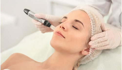stitsville+ottawa+on+microneedling Microneedling treatment